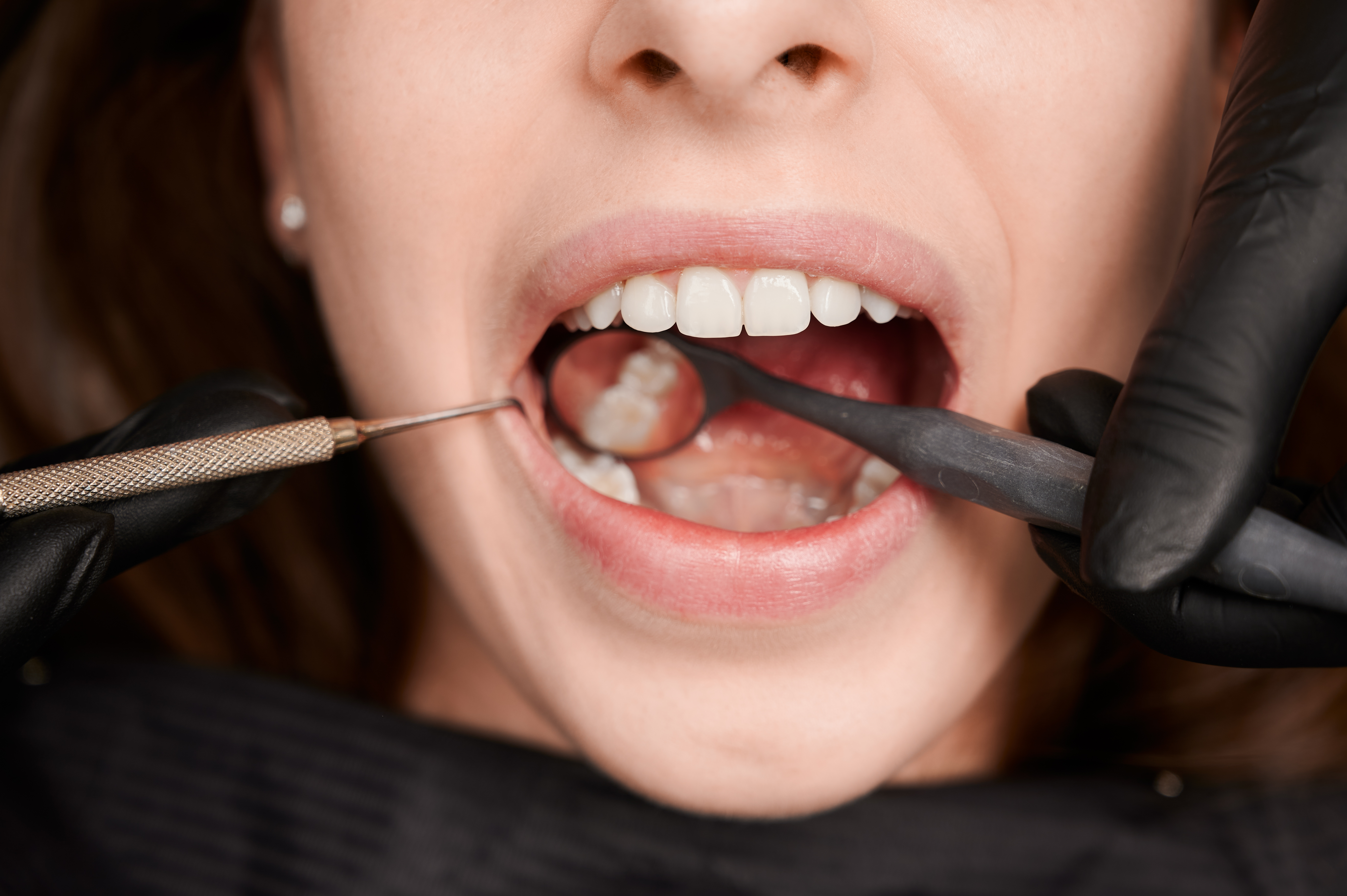 Campaña Cero Caries